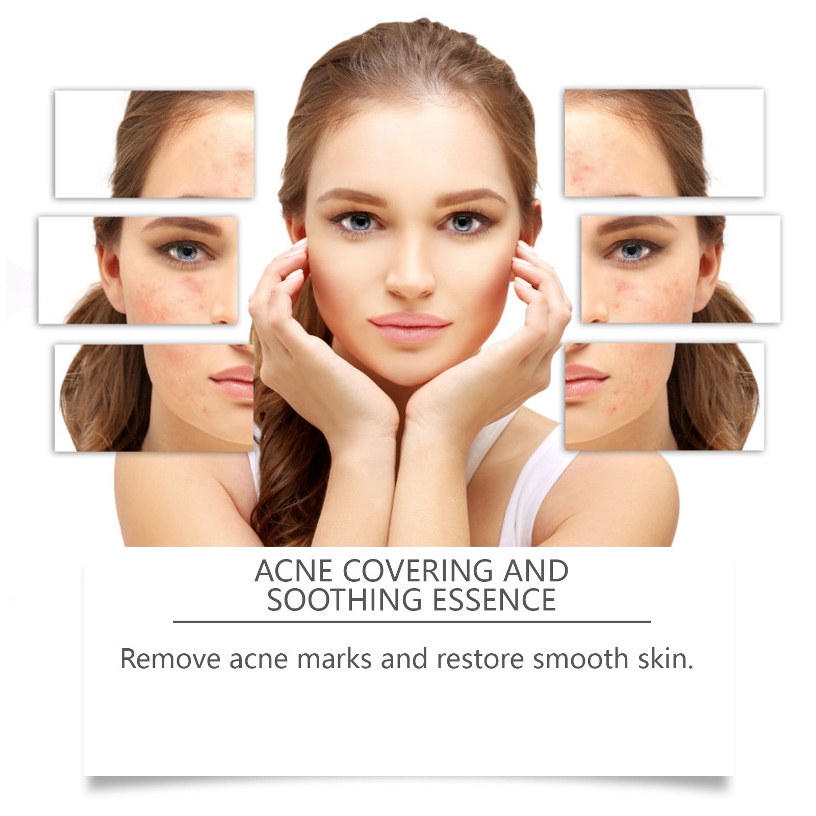 Acne Soothing Facial Serum Hydrating Pimple Care Solution